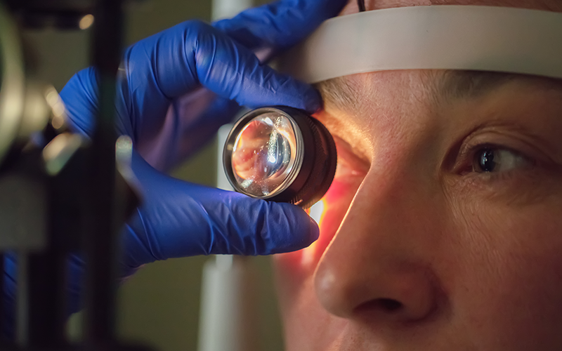 Keratakonus Tedavisi