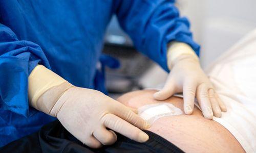 Kıl Dönmesi Ameliyatı