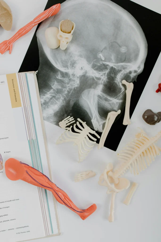 osteomalazi - Magnet Hastanesi Ankara