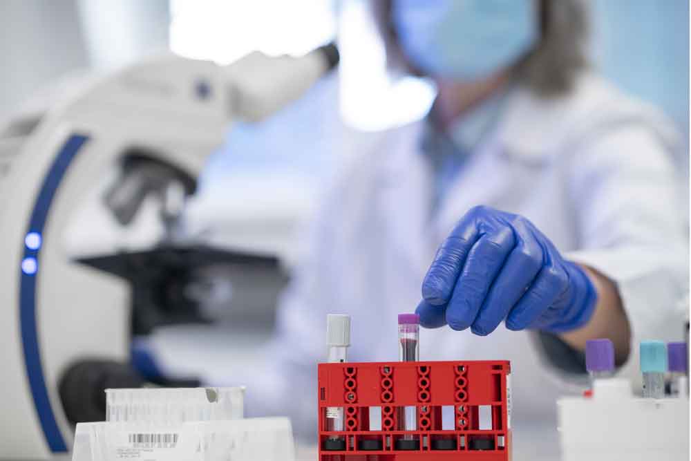 Alkalen Fosfataz (ALP)