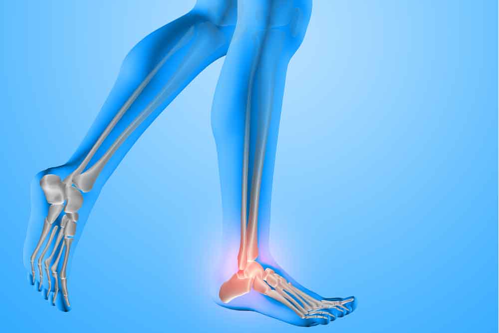 Kaval kemiği ağrısı