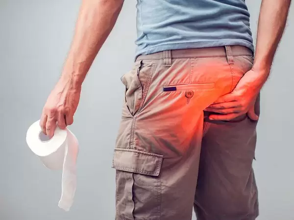 Anal Fistül (Makat Çatlağı) Ameliyatı