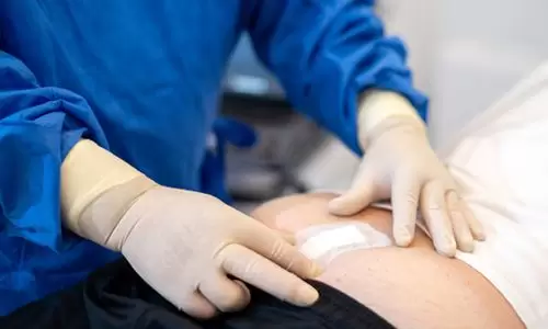 Kıl Dönmesi Ameliyatı (Pilonidal Sinüs )