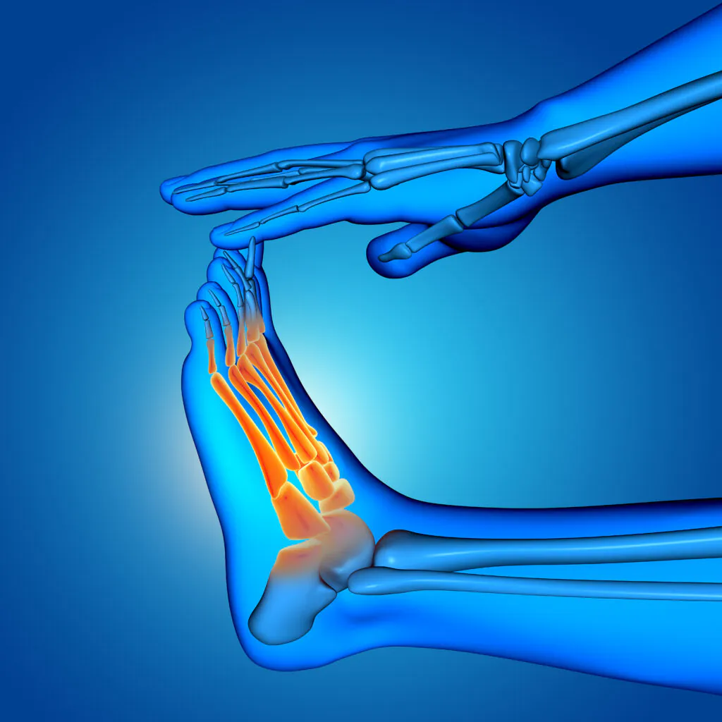 Tarsal Tünel Sendromu Nedir? Belirtileri ve Tedavi Yöntemleri